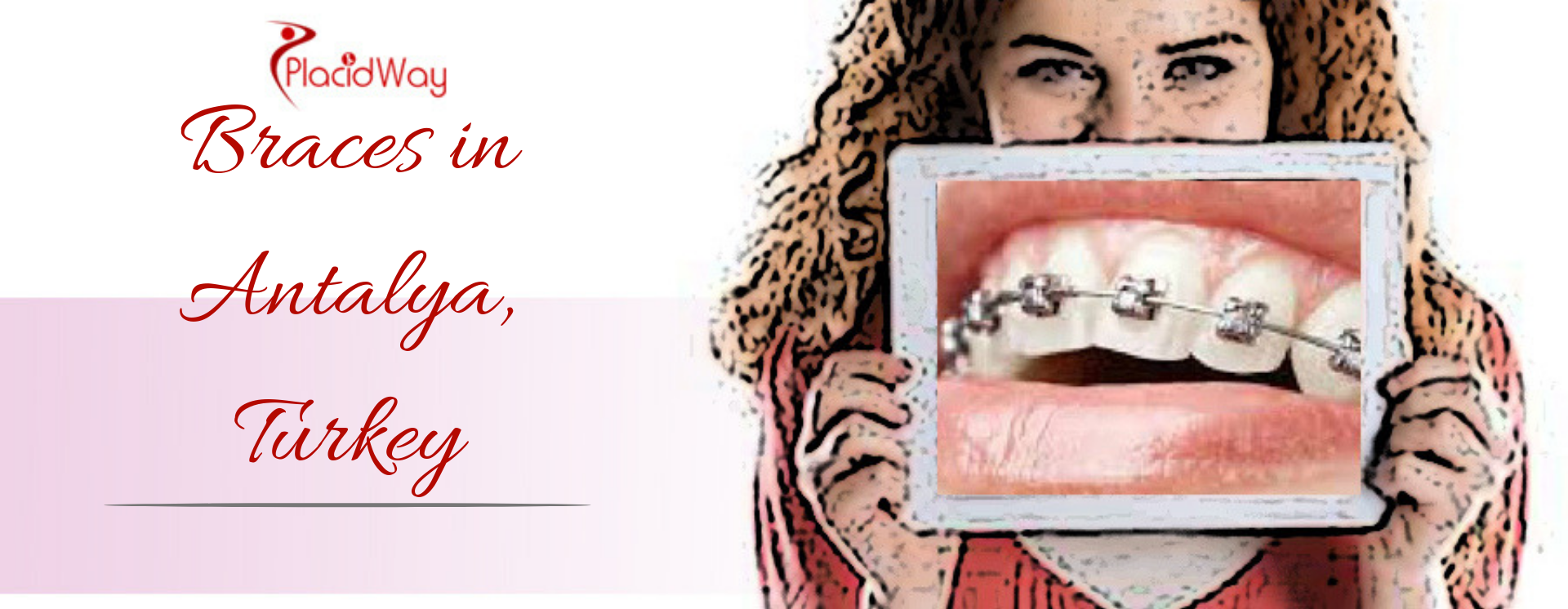 Braces in Antalya, Turkey